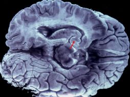 Es necesario mantener la reserva energética adecuada para el buen funcionamiento del órgano. EFE / ARCHIVO