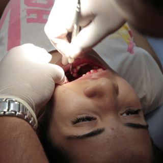 Mujeres son más susceptibles a padecer úlceras bucales