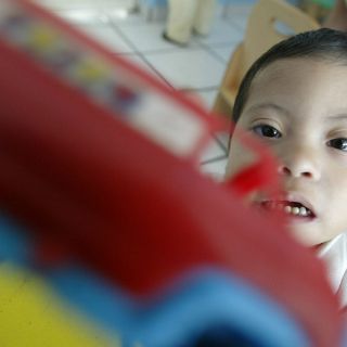 Medicina mejora calidad de vida a personas con Síndrome de Down