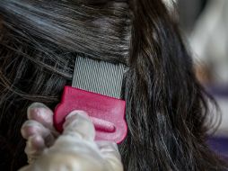 Después del shampoo y jabones con permetrina se debe complementar el cuidado con el uso de un peine de dientes finos. EL INFORMADOR / ARCHIVO