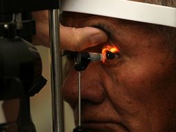 La pérdida de la visión asociada con la OCVR no duele y es repentina. EFE / ARCHIVO