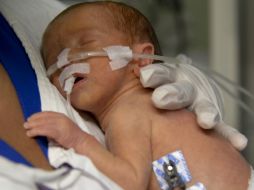 Si un bebé nace con bajo peso o antes de 30 semanas, es posible que los ojos no se desarrollen de forma adecuada. AFP / ARCHIVO