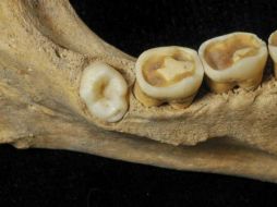 El mal estado de la dentadura confirma que la salud bucodental a partir del Neolítico empeora en las poblaciones agrícolas y ganaderas. TWITTER / @agencia_sinc