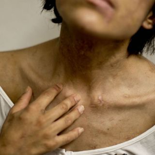 Joven sometida a trabajo forzado escapa tras dos años de cautiverio