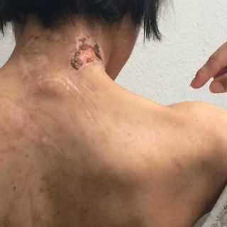 La CDHDF indaga caso de joven esclavizada en Tlalpan