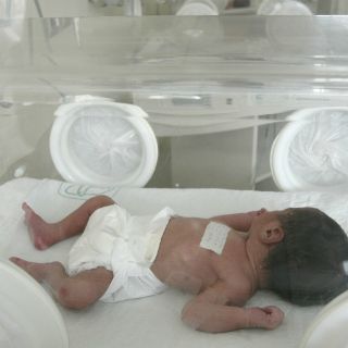 Riesgo de autismo aumenta en bebés prematuros