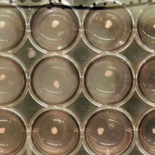 Tipo de célula madre abre una nueva vía para crear órganos