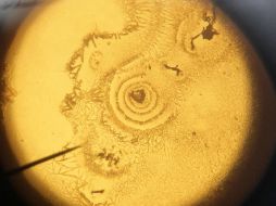 La investigación demuestra que las células madre pueden producir 'in vivo' cartílago articular estable. EFE / ARCHIVO