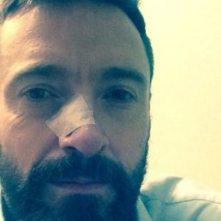 Hugh Jackman ha tenido cáncer cuatro veces en año y medio