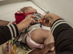 La vacuna no debe aplicarse si el menor tiene antecedente de un evento grave o reacción alérgica a dosis previas. EL INFORMADOR / ARCHIVO