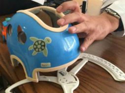 La órtesis corrige la zona deformada al realizar presión y conforme crece el cráneo, el casco le permite ubicarse en la zona correcta. FACEBOOK / bionicafixyou
