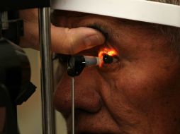 La enfermedad se puede corregir con el uso de lentes de gas permeables, que son rígidos o duros. EL INFORMADOR / ARCHIVO