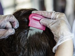 Para evitar la pediculosis es hay que lavar, peinar y cepillar diariamente el cabello, y revisar periódicamente la cabeza de los niños. EL INFORMADOR / ARCHIVO