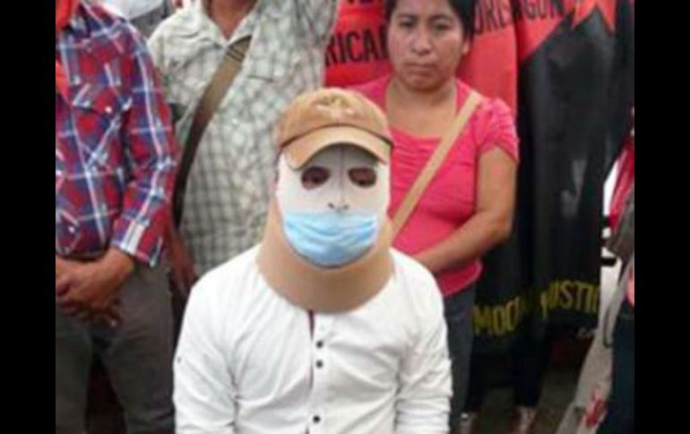 Señaló que continuará con los tratamientos médicos y cuidados especiales para continuar su proceso de recuperación. SUN / O. Gutiérrez