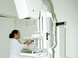 La investigación demostró científicamente porque las mujeres hispanas-latinas tienen una tasa menor de cáncer de mama. NTX / ARCHIVO