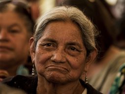 Las personas de raza blanca tienen cuatro veces más de riesgo de padecer esta enfermedad. EL INFORMADOR / ARCHIVO