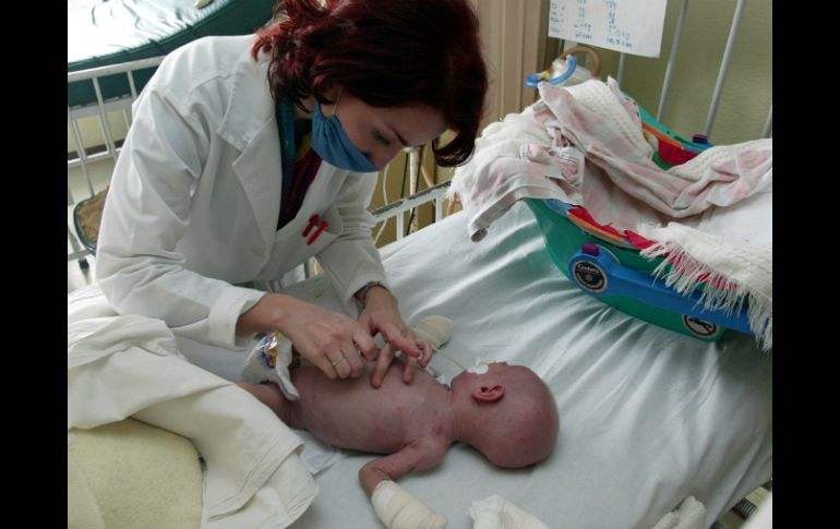 Todo niño que tenga una diarrea aguda debe ser tratado por un médico y evaluar si está deshidratado o no. EL INFORMADOR / ARCHIVO