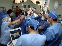 Si personas trasplantadas presentan una infección fúngica y no tuvieron un tratamiento preventivo, solo sobrevivirá la mitad. EFE / ARCHIVO