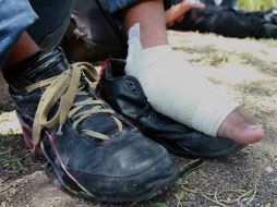 El debilitamiento óseo se debe a la alteración de las fibras de proteína que se encuentran al interior de los huesos. EL INFORMADOR / ARCHIVO