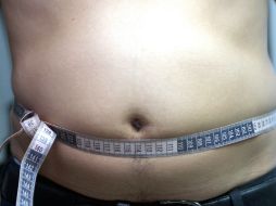 El equilibrio de la microbiota intestinal es fundamental para un adecuado estado de salud. EL INFORMADOR / ARCHIVO