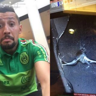 Yasser Corona, baja del Tri por lesión