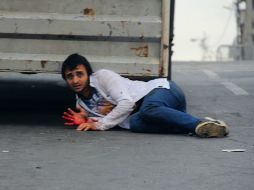 Un hombre herido se encuentra en una calle durante los enfrentamientos que provocó el ataque del consulado de EU en Estambul. AFP /