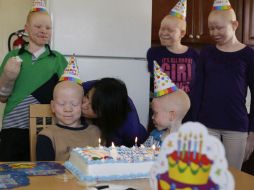 Cinco niños que padecen la enfermedad fueron llevados a Estados Unidos por el Global Medical Relief Fund. AP / J. Jacobson