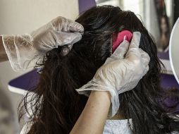 El continuo uso de sustancias ha provocado que los piojos evolucionen de tal manera que los productos ya no encajan en los receptores. EL INFORMADOR / ARCHIVO