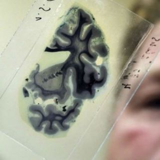 Neurosis y creatividad estarían asociadas: científicos