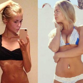 Joven muestra su lucha contra la anorexia en Instagram