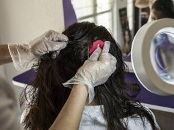 Los piojos son insectos parasitarios sin alas; habitan en la cabeza del individuo y se alimentan de su sangre. EL INFORMADOR / ARCHIVO