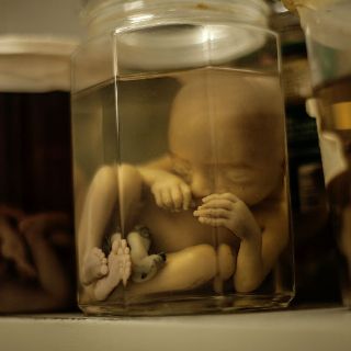 Injerto de células madre en fetos trataría enfermedades de huesos