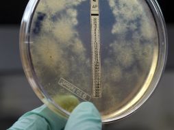 La bacteria del meningococo causa el fallecimiento de 30 mil personas al año. EFE / ARCHIVO