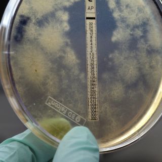 Meningitis tiene alta letalidad y es prevenible con vacuna