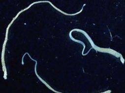 El médico dijo que 72 horas antes de que el paciente muriera, se descubrió que una lombriz solitaria le trasmitía células cancerosas. ESPECIAL / Image Library/CDC
