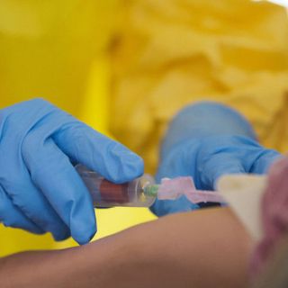 Brasil investiga posible caso de ébola