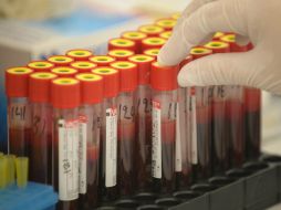 En Jalisco, cuatro mil 800 personas portadoras de VIH que se encuentran bajo tratamiento. EFE / ARCHIVO