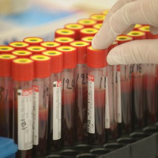 Sector Salud Jalisco anuncia campaña sobre prevención del SIDA