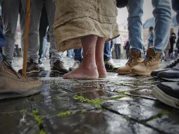 Los niños no tratados enfrentan problemas al caminar y no pueden usar zapatos normales. NTX / ARCHIVO
