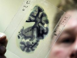 Un estudio realizado en seis mil personas demostró que los cerebros de ambos sexos son iguales. EL INFORMADOR / ARCHIVO