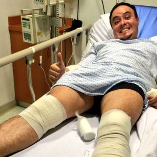 Integrante de Río Roma sufre accidente en motocicleta