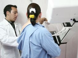 En al menos tres de cada 10 casos los resultados de las mamografías no son entregados. EL INFORMADOR / ARCHIVO