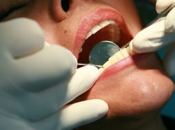 Recomiendan acudir con un dentista para que ofrezca diversas opciones de blanqueamientos dentales seguros. EL INFORMADOR / ARCHIVO