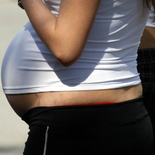 Antidepresivos durante el embarazo aumentan el riesgo de autismo