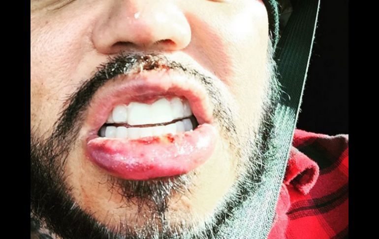 El fundador de Kumbia Kings subió una fotografía a Instagram donde se le ve con una dentadura provisional. INSTAGRAM / @abquintanilla3