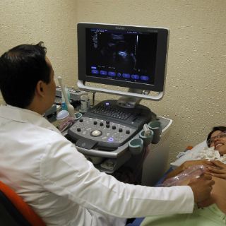 La presencia silenciosa de los fibromas uterinos