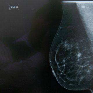 Analizan nuevas técnicas para mejorar resultados de imágenes médicas