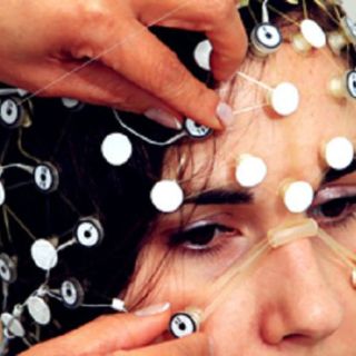 Casco craneal diagnosticaría enfermedades neurodegenerativas