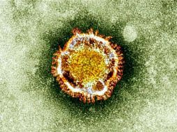 El trabajo puede abrir la vía a nuevos tratamientos dirigidos al tumo antes de que comience a desarrollarse. AFP / ARCHIVO