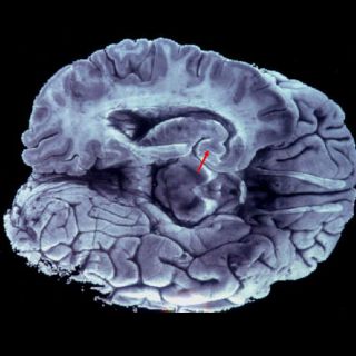 Crean una réplica en tercera dimensión del cerebro humano